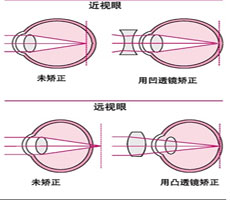 症状