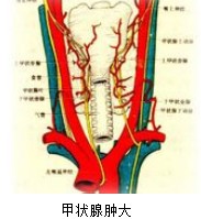 疾病简介