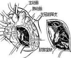 成人室缺的原因