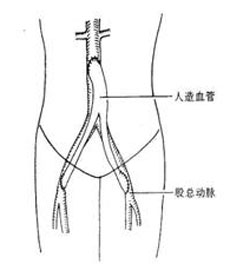 临床诊断