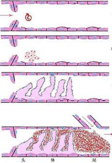 病理生理