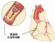 致病原因