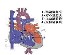 治疗技术