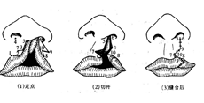 临床表现