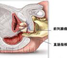 球蛋白