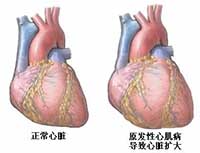 疾病介绍