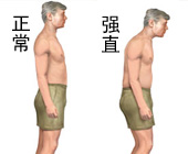 疾病症状