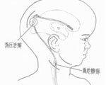 发病原因