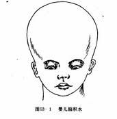 诊断