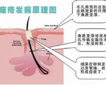 临床表现