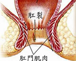 临床表现