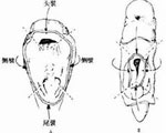 脐膨出的基本信息