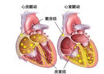 产前诊断