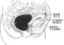 诊断检查