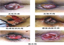 饮食禁忌