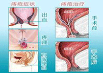 注意事项