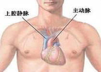 临床治疗