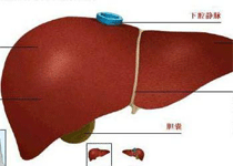 肝硬化症状变化