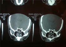 解剖结构