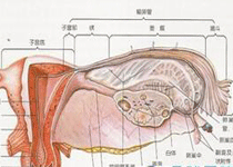 皮样囊肿畸胎瘤