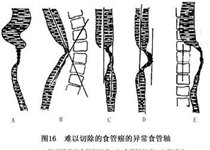 发病机理