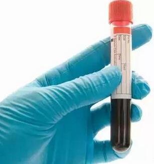 透析患者肌酐、尿素氮越低越好吗？