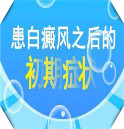 南京治白癜风好的医院&身上的白斑要怎么诊断
