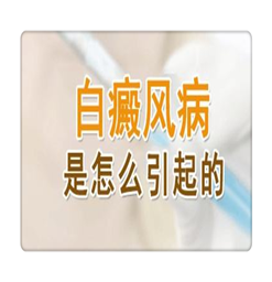 南京看白癜风好的医院？白癜风的病因是什么？