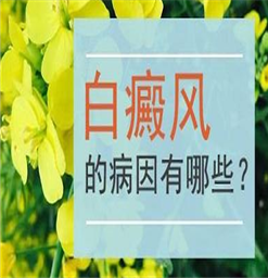 宿迁哪家白癜风好&什么原因会引起白斑发生