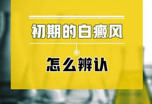宜春老年白癜风的症状表现有哪些?