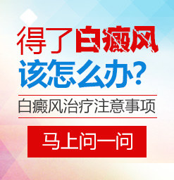 沧州白癜风治疗好的医院？饮食可以促进白癜风的治疗吗？