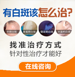 沧州治白癜风的医院？白癜风怎么吃比较好呢？