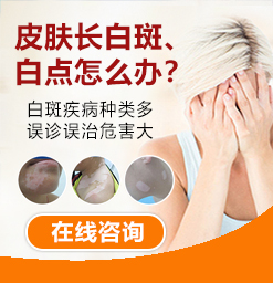 沧州治白癜风的医院？白癜风的危害是什么呢？