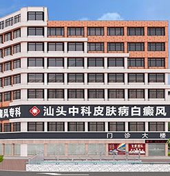 枸杞叶发黑了白癜风病患还能吃吗