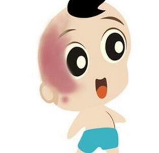 济南专业治疗红胎记哪里比较好