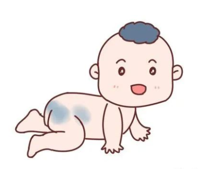济南哪个医院看胎记比较专业