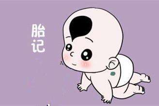 济南治疗胎记的正规医院