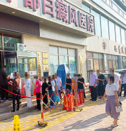 沧州白癜风医院?白癜风什么症状呢?