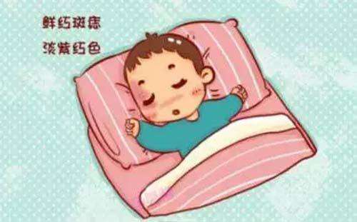 鲜红斑痣可以自行消退吗？