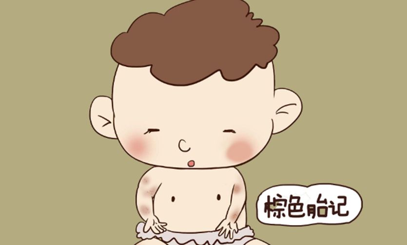 济南哪个医院能治疗胎记