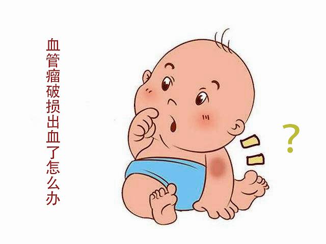 在济南看血管瘤去哪个医院比较好