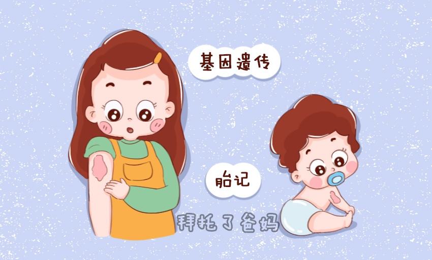 济南正规胎记医院治疗费用需要多少