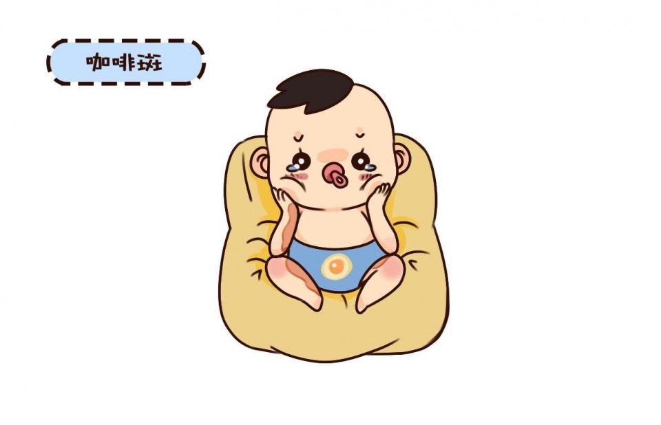 济南治疗咖啡斑要多少钱？