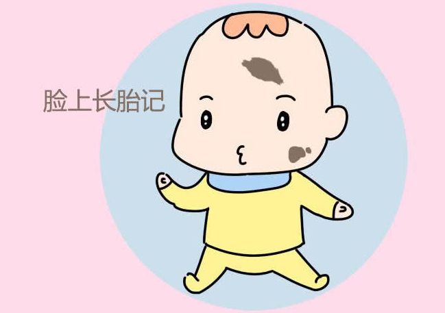 济南胎记医院治疗太田痣哪家排名好？
