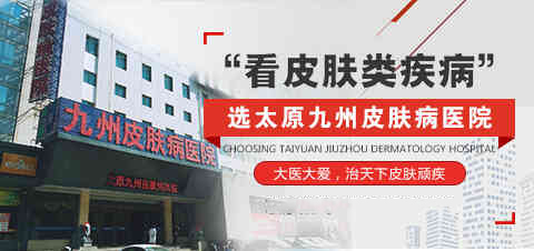 太原专业治疗皮肤的医院_脸上为什么长痣?
