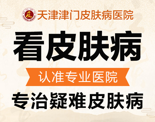 天津哪家鱼鳞病医院比较好-看鱼鳞病天津哪里好