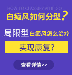 东莞虎门能治疗好白癜风吗？白癜风的病因有哪些呢？