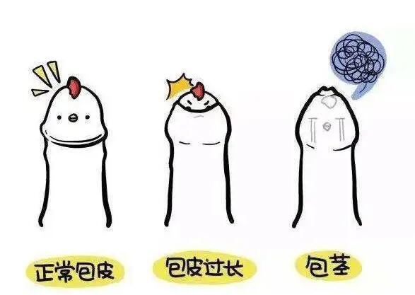 成都哪家医院做包皮手术好