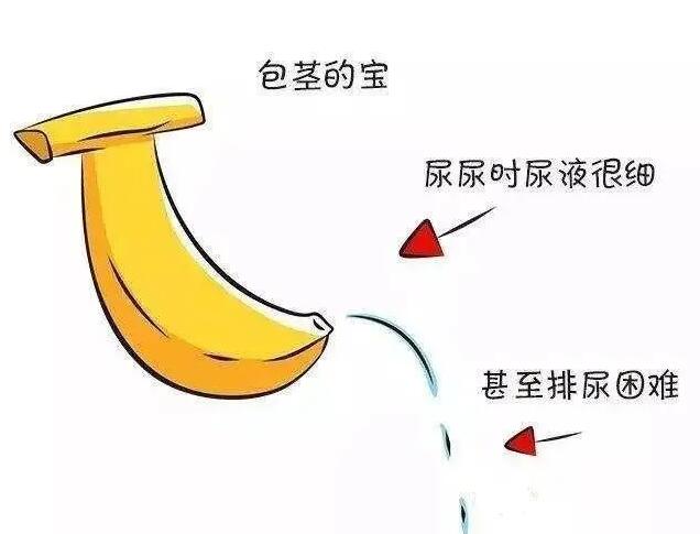 包皮手术后出现严重水肿怎么办