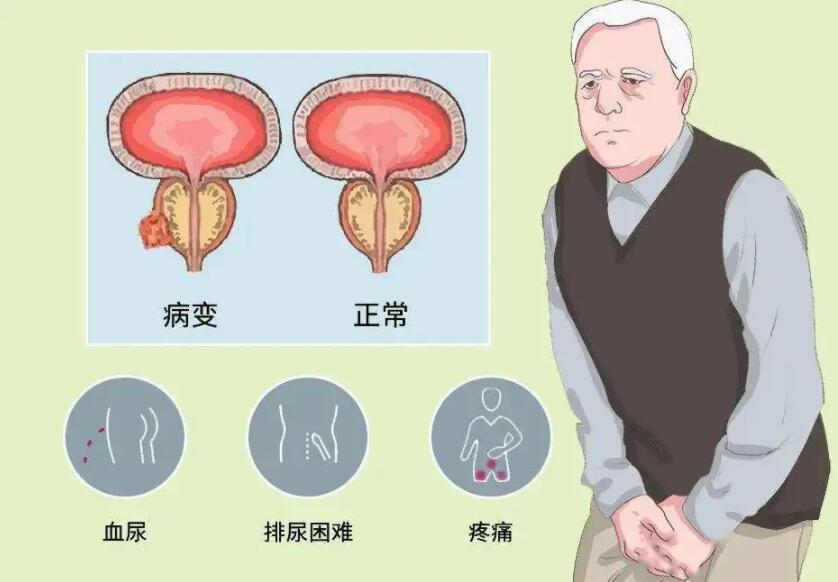 成都新都男性医院那家好